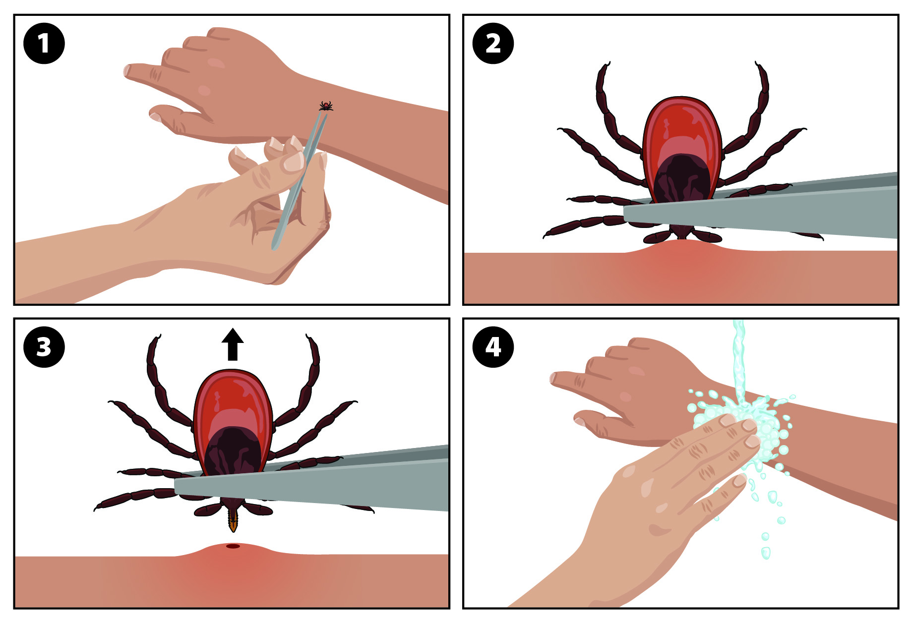 Tick Removal Graphic